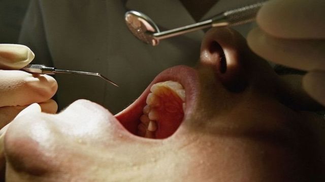 الأسنان البيضاء لا تعني بالضرورة أنها صحية Bbc News عربي