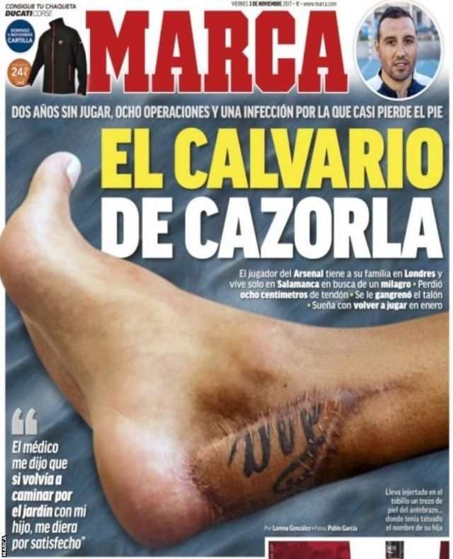 668 días jugar una bacteria que le fue "comiendo" el tendón, el que pasó futbolista español Santi Cazorla - BBC News Mundo