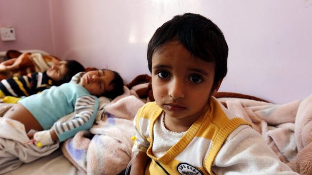 وباء الكوليرا في اليمن