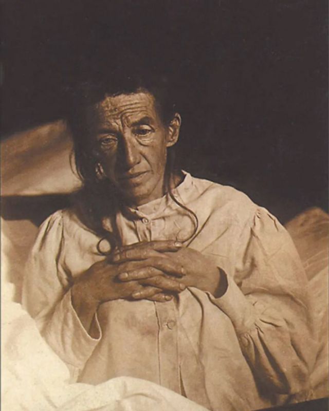在二十世纪初，德国女子奥古斯特·迪特是第一个确诊的阿兹海默症患者（Credit: Wikipedia）(photo:BBC)