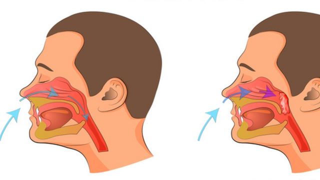 Ilustração do sistema respiratório