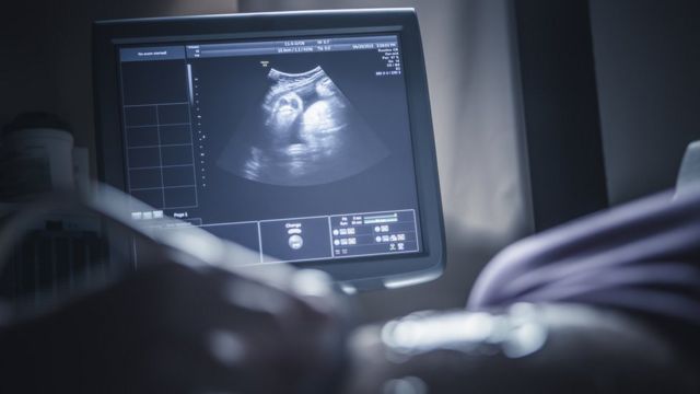 La Cirug A Experimental Que Cambia De Lugar El Tero Para Mantener La Fertilidad De Una Paciente
