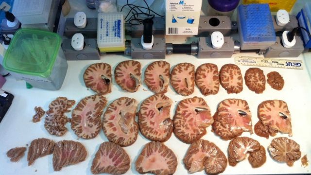 Cérebros fatiados em laboratório de neurociência coordenado por Herculano-Houzel no Rio
