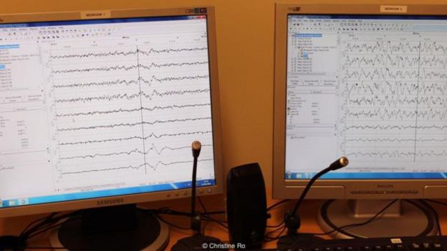 monitor de electroencefalografía,