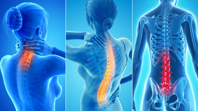 Tres imágenes de dolores de espalda: cervical, dorsal y lumbar