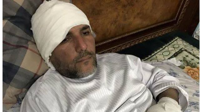 په برید کې افغان سوداګر حاجي محمد صدیق مهمند هم ژوبل شوی