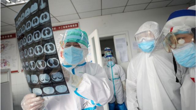 Dr. Fan Zhongjie, left, a respiratory specialist in charge of about 30 critical COVID-19 patients in his section, works in a hospital in Wuhan in central China's Hubei province Monday, Feb. 24, 2020.