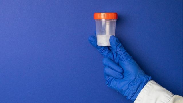 muestra de semen