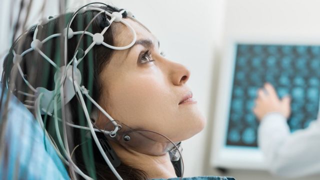 EEG du cerveau