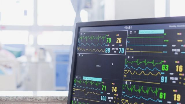 Monitor de una habitación de hospital