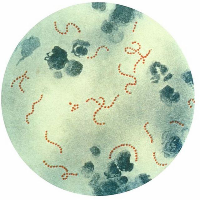 Streptococcus pyogenes,