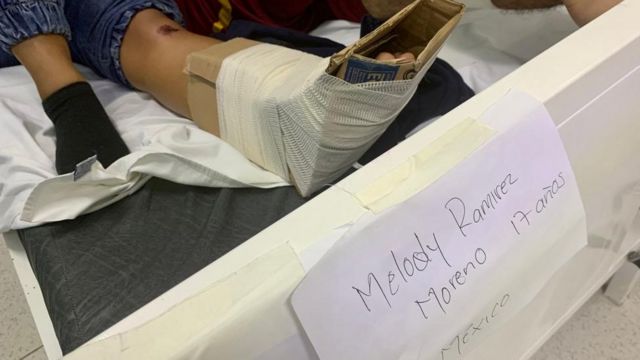 Melody, una de las heridas que prefiere no revelar su rostro