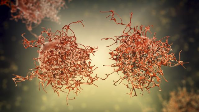 செர்விகல் கேன்சர்