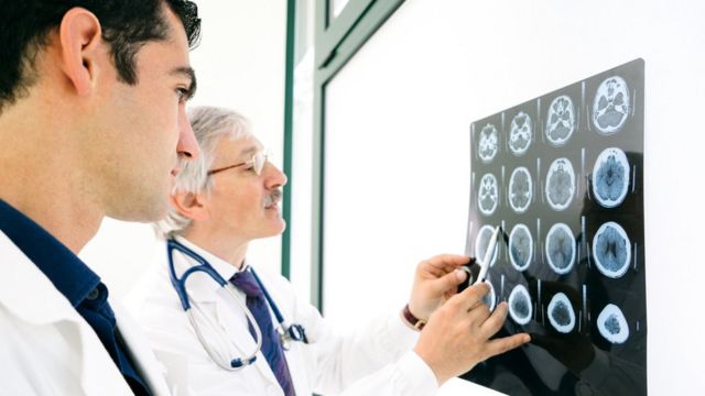 Médicos mirando un escáner cerebral