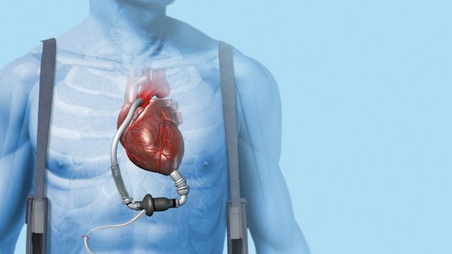 Как не навредить сердцу во время тренировки: советы врача - горыныч45.рф