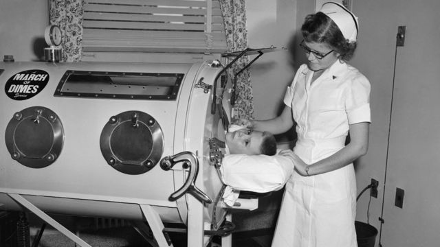 美国加州某医院内一位患上脊髓灰质炎男童在“铁肺”内接受治疗（1958年）