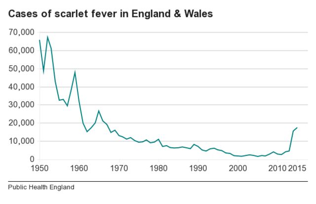 Scarlet fever cases surge to more than twice seasonal average