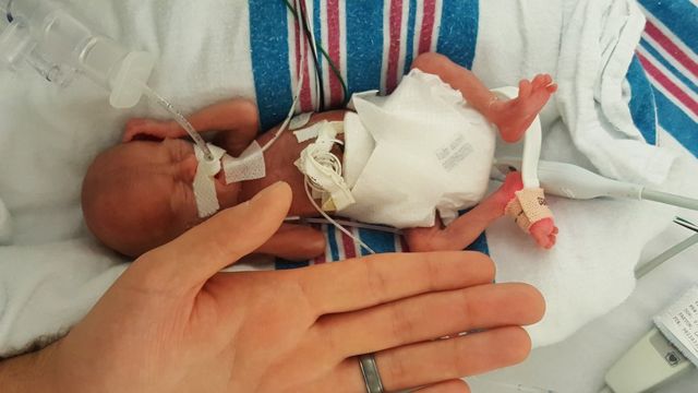 Connor em julho de 2018, poucos dias após nascer, ao lado da mão do pai, John Florio