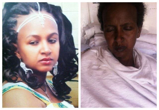 የመአዛ ካሳ የቀድሞ ፎቶና ሆስፒታል ከገባች በኋላ የተነሳ ፎቶ
