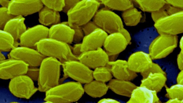 Бактерии Bacillus anthracis создают весьма долговечные споры