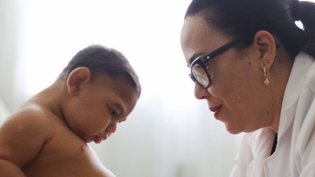 Bebé en Brasil que padece microcefalia con una médica