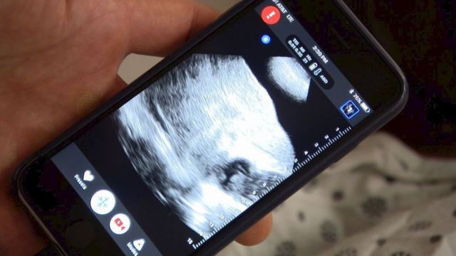 世界を揺るがす デジタル技術で医療革命 誰もが医者に cニュース