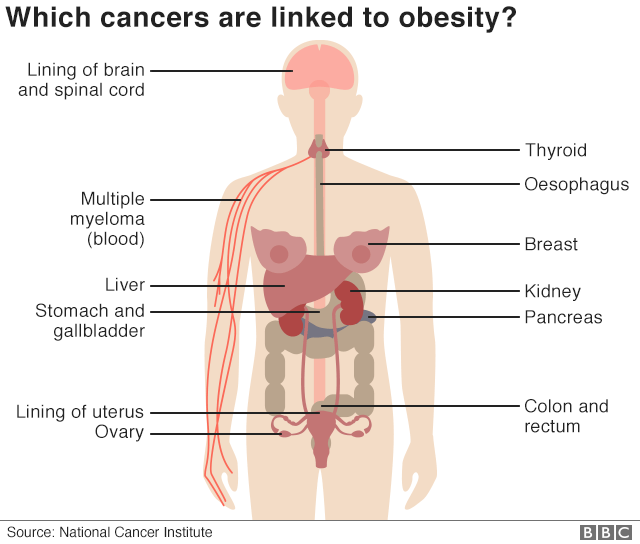 Infographic shows female human body and indicates parts of the body where obesity is linked to cancer