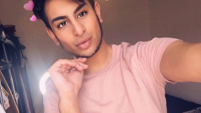 Junaid reconoce que se puso bótox en varias zonas de la cara para "mejorar" su aspecto. (Foto: Junaid Ahmed).