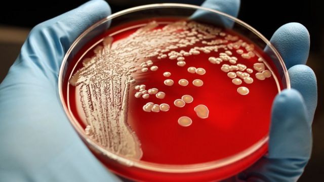 O Staphylococcus aureus em uma placa para estudos científicos