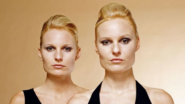 同卵双胞胎和异卵双胞胎的区别并非总是很明显（Credit: Science Photo Library）(photo:BBC)