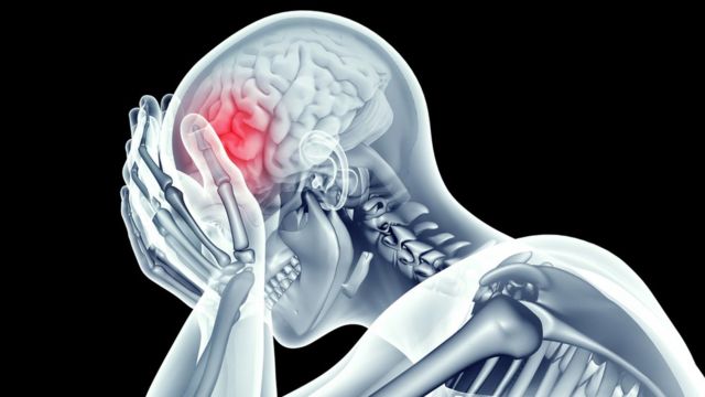 Alguns tipos de dores de cabeça são regulares, acometendo os pacientes no mesmo período do ano