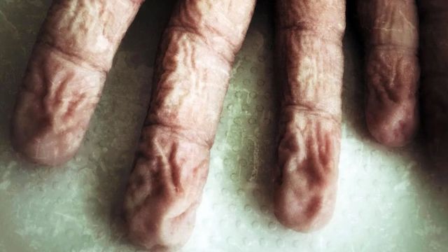 விரல் சுருக்கங்கள்