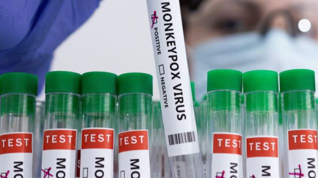 Scientist grabs test pot labeled 'monkeypox virus'