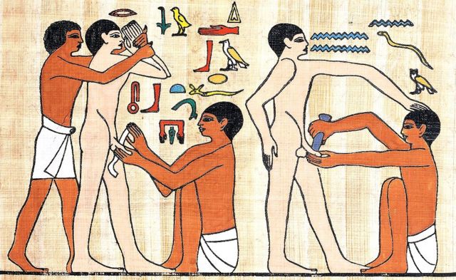 Imagem de circuncisão no Egito antigo