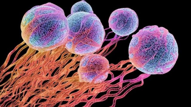 Ilustração de células cancerígenas