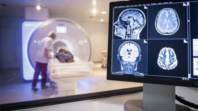MRI scanning of the brain
