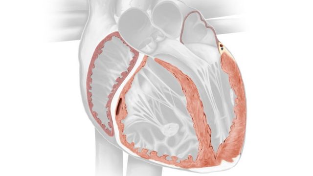 Ilustración del Miocardio