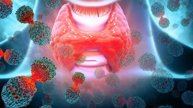 கருச்சிதைவை ஏற்படுத்தும் தைராய்டு பிரச்னை