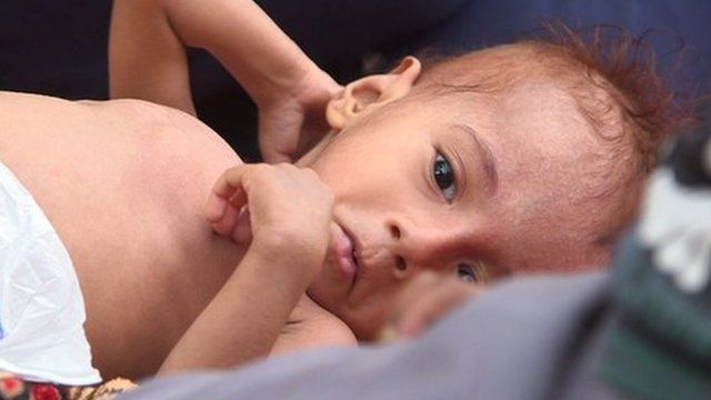 A child in Yemen