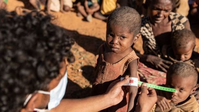 ஊட்டச்சத்து குறைபாடுள்ள குழந்தைகள்