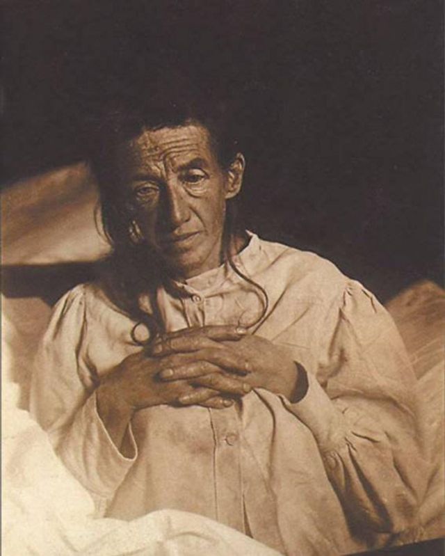 Idosa Auguste Deter em cima de uma cama