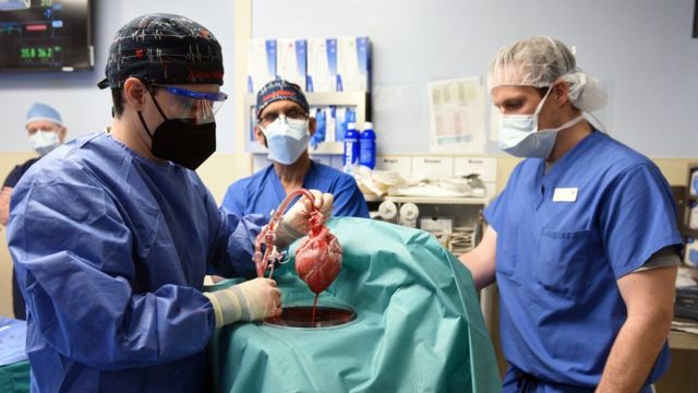 The first pig-to-human-heart transplant was carried out in Baltimore