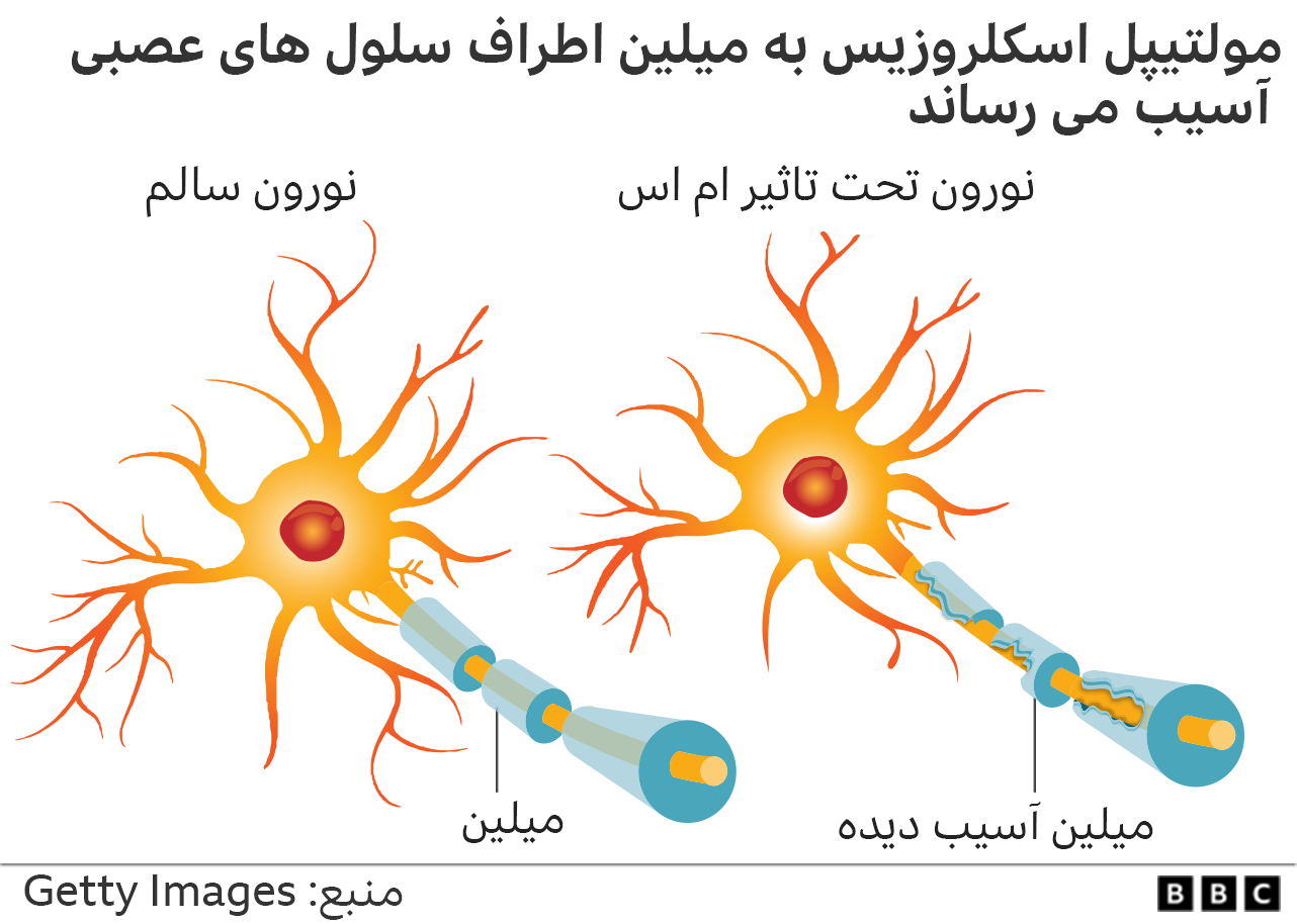 ام اس