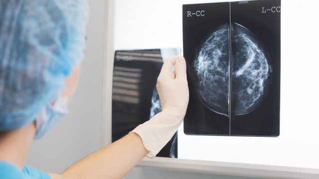 The doctor analyzes the mammogram