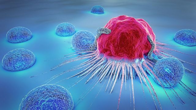 Por qué hay científicos que quieren dejar de llamar cáncer a algunos  tumores - BBC News Mundo