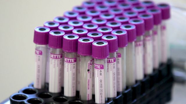La clinique médicale Hadassah de Moscou effectue des tests d'anticorps contre les coronavirus