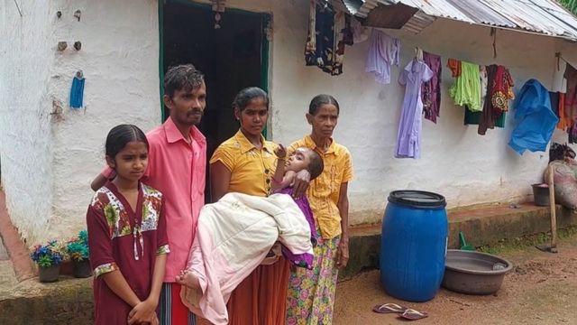 ஊட்டச்சத்துக் குறைபாடு