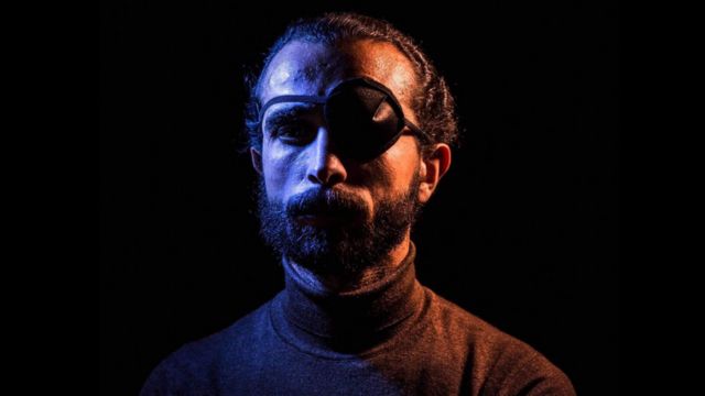 أحمد فقد عينه أثناء مشاركته في "جمعة الغضب" في يوم 28 يناير