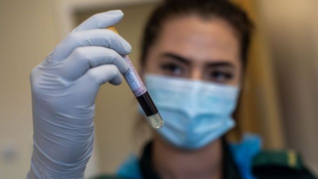 آزمایش پادتن می‌تواند نشان دهد شخص قبلا به ویروس کرونا مبتلا بوده یا نه