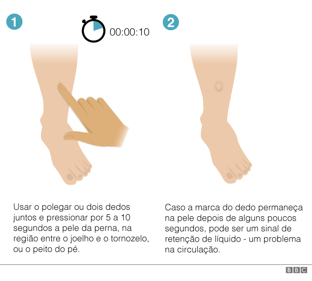 Oito sinais que o corpo podem mostrar que você está infartando